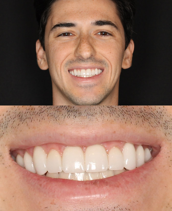 Before Image