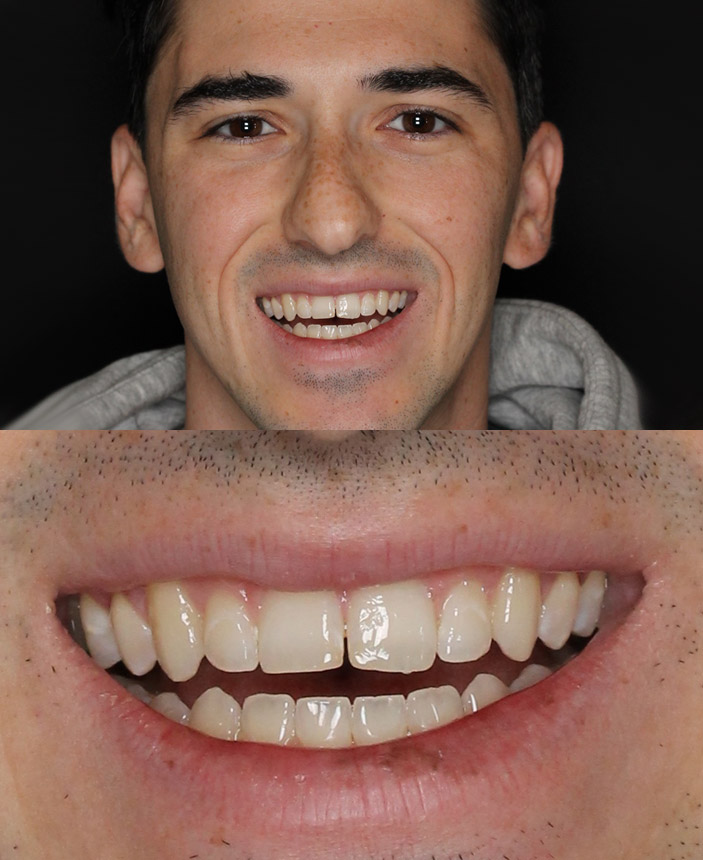 After Image