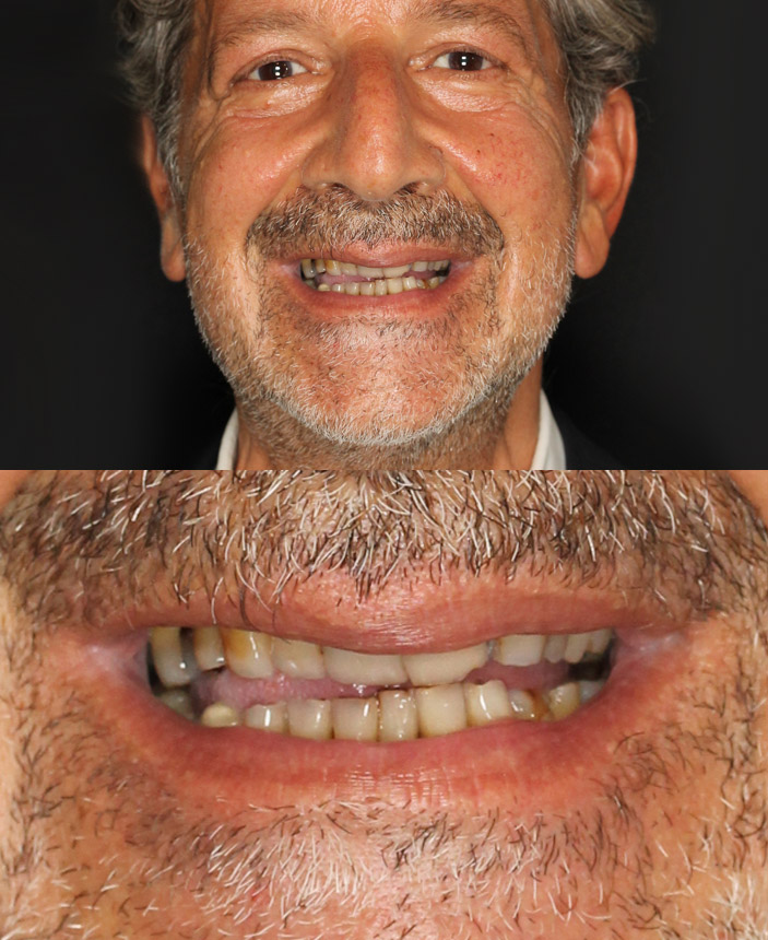 After Image