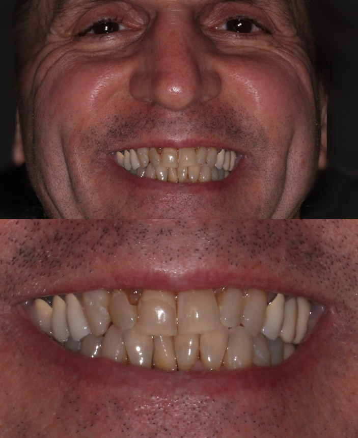 After Image