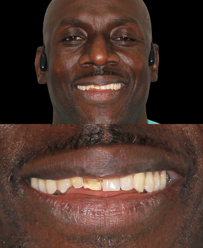 After Image