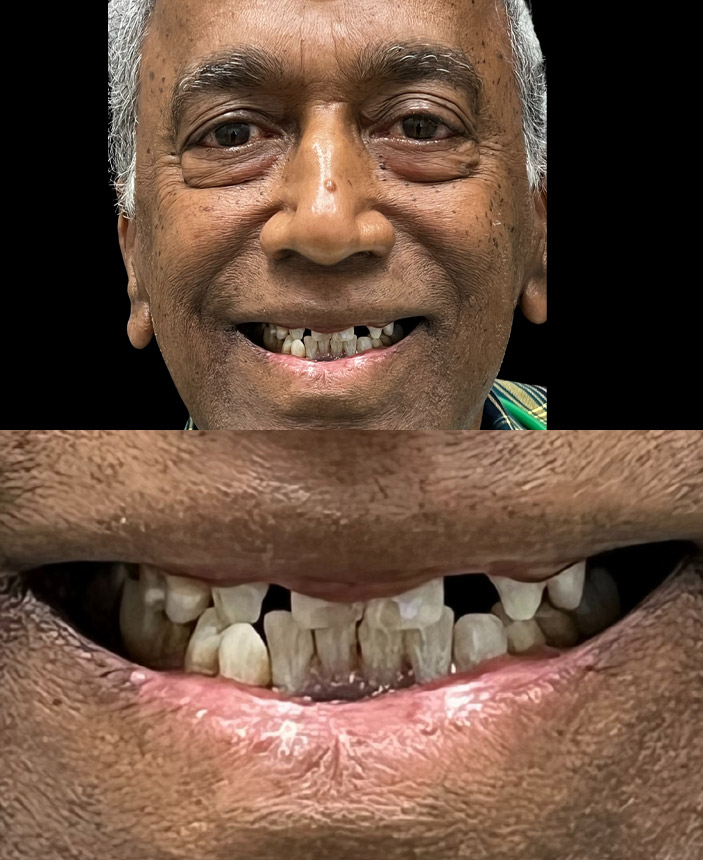 After Image
