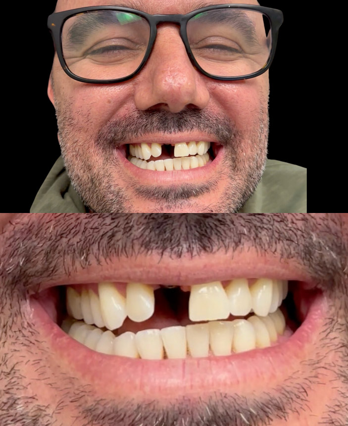 After Image