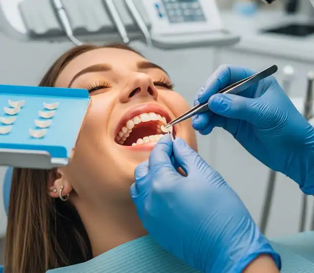 Porcelain Veneers