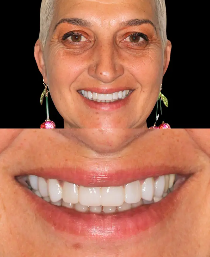 After Image