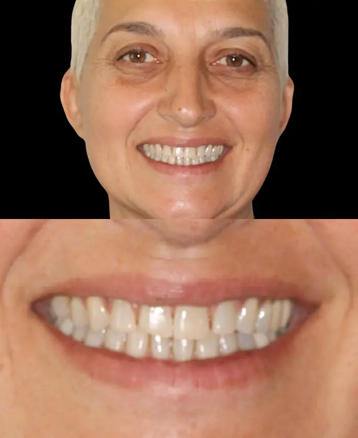 Before Image